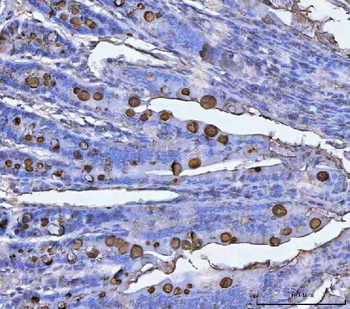 Anti-TFF3 Antibody