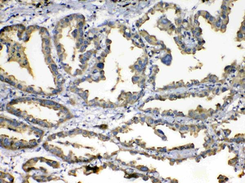 Anti-Superoxide Dismutase 3/SOD3 Antibody