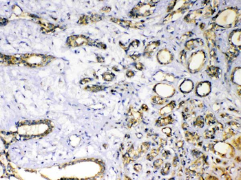 Anti-Superoxide Dismutase 3/SOD3 Antibody