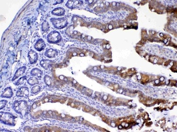 UGT1A1 Antibody