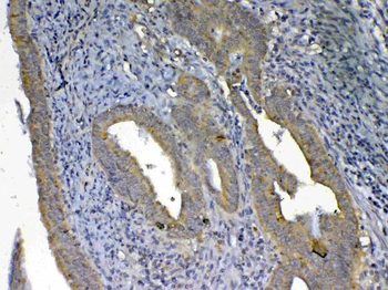 Anti-UGT1A1 Antibody