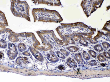Anti-UGT1A1 Antibody
