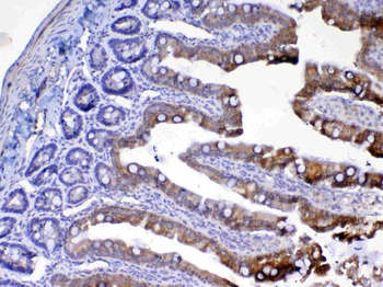 Anti-UGT1A1 Antibody