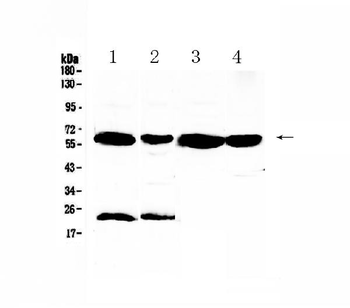 Anti-UGT1A1 Antibody