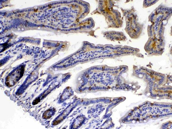 Anti-Xanthine Oxidase/XDH Antibody