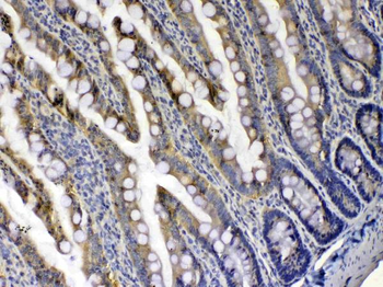 Anti-Xanthine Oxidase/XDH Antibody
