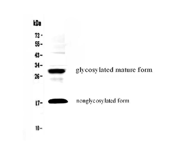 IL17F Antibody