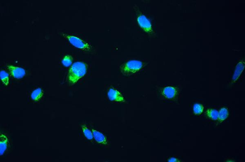 Anti-FH Antibody