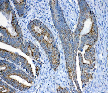 Anti-FH Antibody