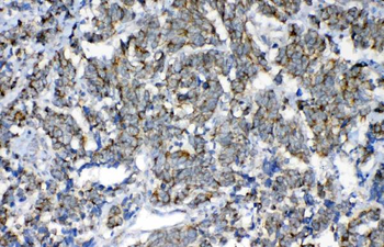 Anti-FH Antibody