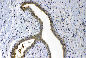 Anti-FH Antibody