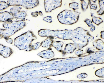 Anti-FH Antibody