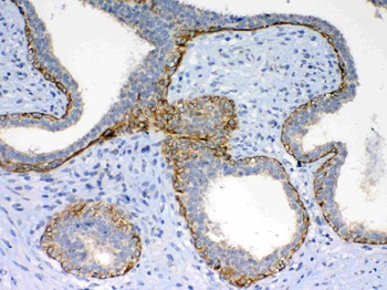 Anti-Frizzled 4/FZD4 Antibody
