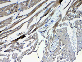 Anti-Frizzled 4/FZD4 Antibody