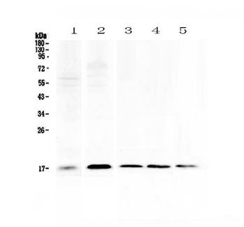 Psoriasin/S100A7 Antibody
