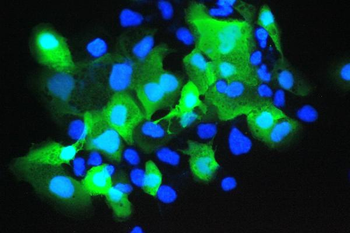 Anti-Psoriasin/S100A7 Antibody