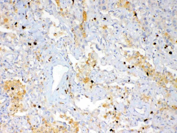 Anti-Psoriasin/S100A7 Antibody