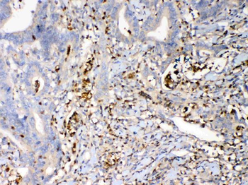 Anti-Psoriasin/S100A7 Antibody