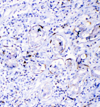 Anti-TL1A/TNFSF15 Antibody