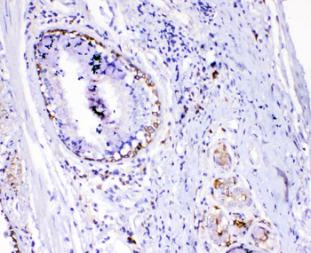 Anti-TL1A/TNFSF15 Antibody