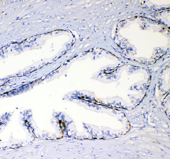 Anti-TL1A/TNFSF15 Antibody