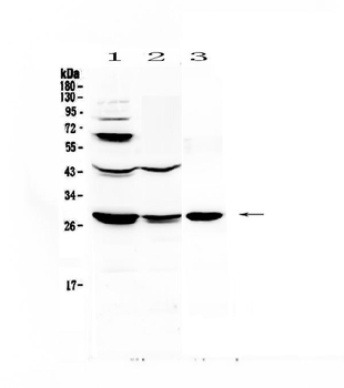 Anti-TL1A/TNFSF15 Antibody