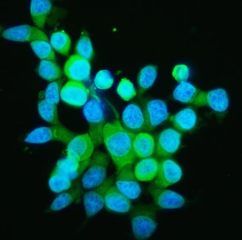 Anti-PPID Antibody