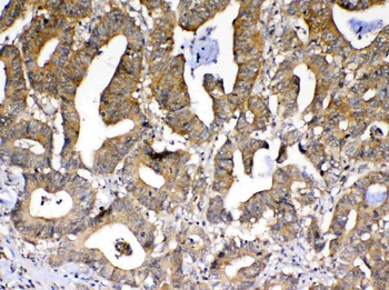 Anti-PPID Antibody