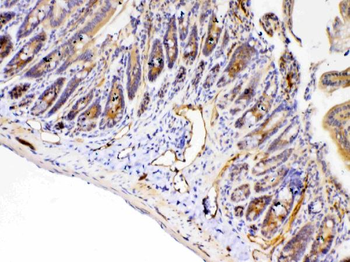 Anti-PPID Antibody