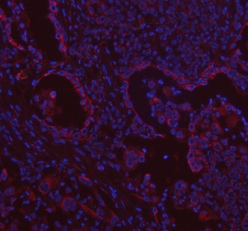 Anti-VE-Cadherin CDH5-Antibody