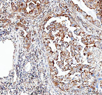 Anti-VE-Cadherin CDH5-Antibody