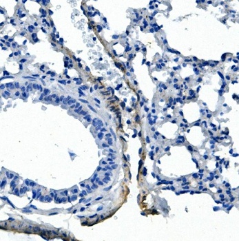 VE-Cadherin CDH5-Antibody