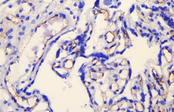 VE-Cadherin CDH5-Antibody