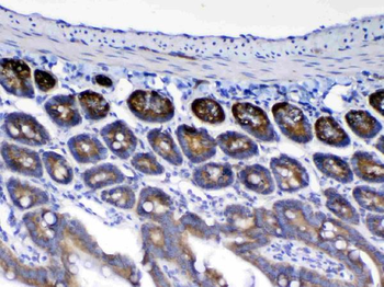 Anti-HE4/Wfdc2 Antibody