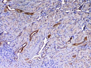 Anti-HE4/Wfdc2 Antibody