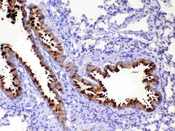 Anti-HE4/Wfdc2 Antibody