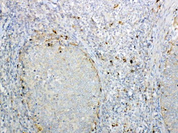 Anti-GALNS Antibody