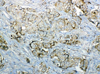 Anti-GALNS Antibody