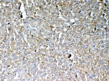 Anti-GALNS Antibody