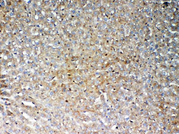 Anti-GALNS Antibody
