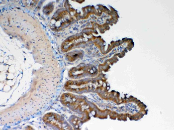 Anti-GALNS Antibody