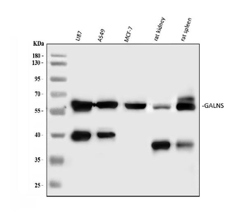 Anti-GALNS Antibody
