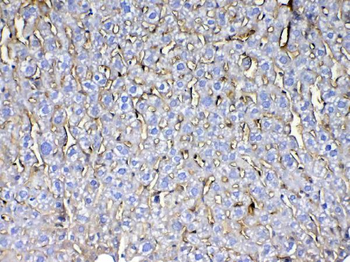 Anti-CD105/Eng Antibody
