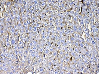 CD105/Eng Antibody