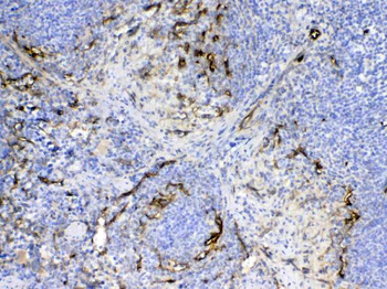 Anti-CD105/Eng Antibody