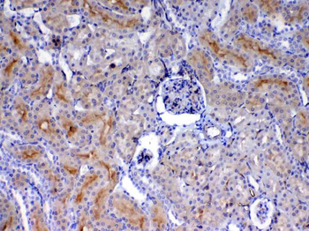 Anti-CD105/Eng Antibody