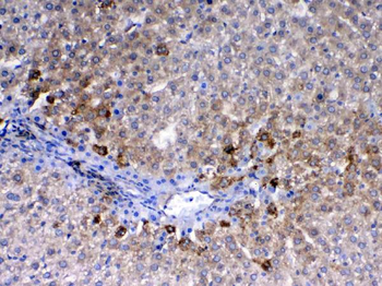 Anti-CD105/Eng Antibody
