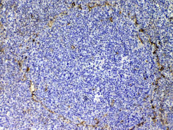 Anti-CD105/Eng Antibody