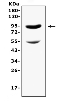 Anti-CD105/Eng Antibody