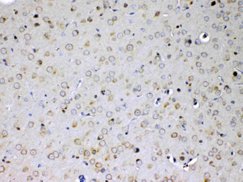 Anti-IL15RA Antibody